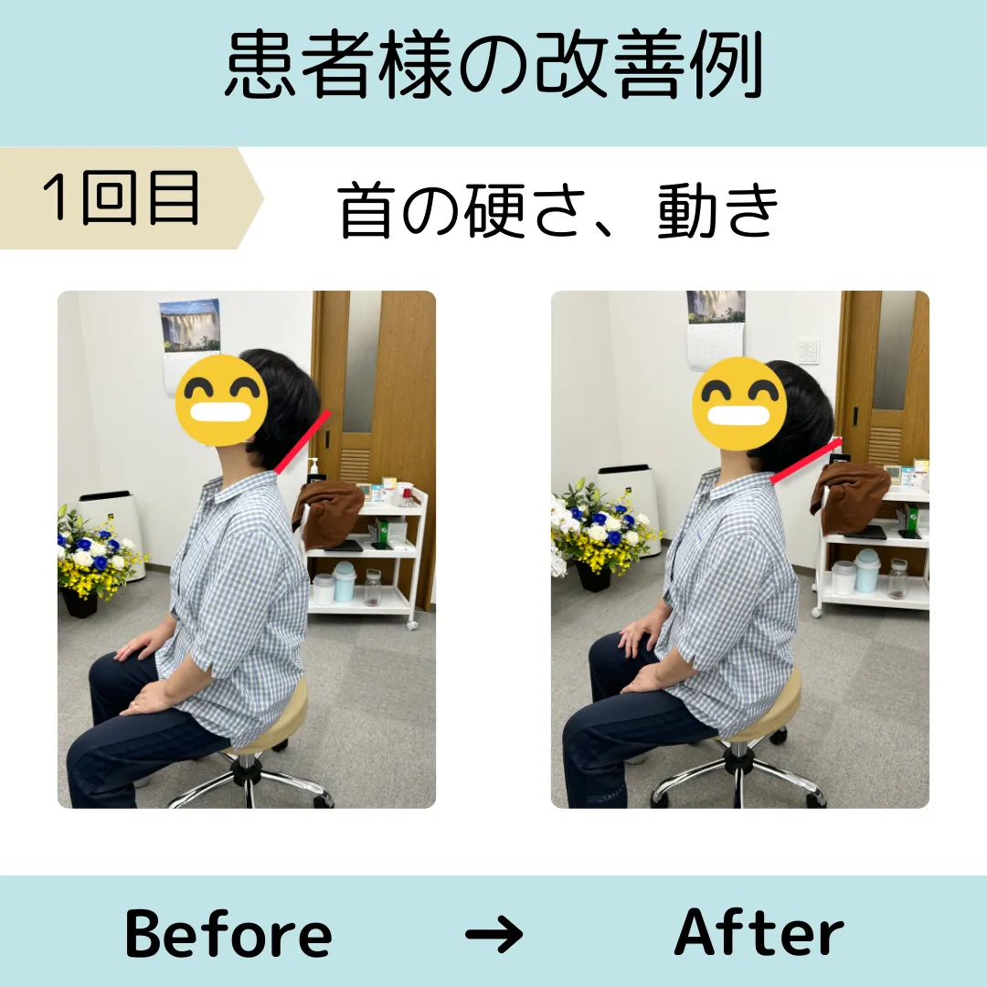 首の痛み