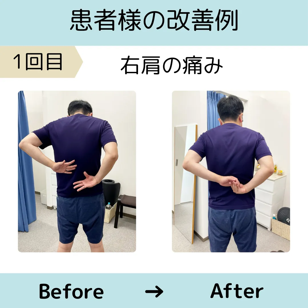 右肩の痛み